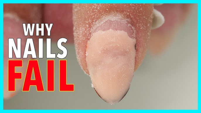 Problem Nails Masterclass