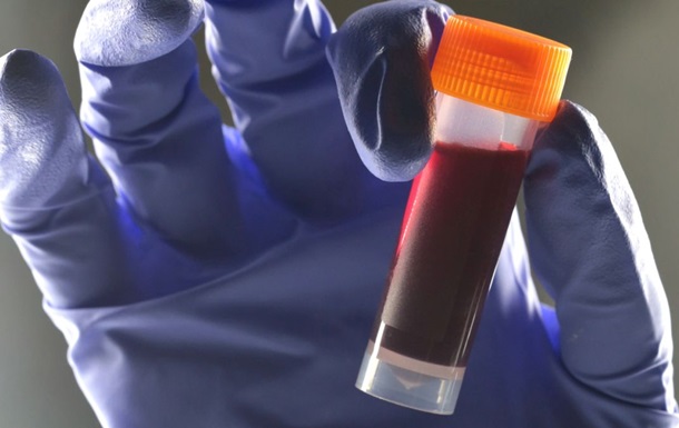 Учёные обнаружили связь между группой крови и риском диабета 2 типа