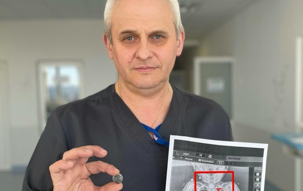 Во Львове спасли ребенка, который месяцами жил с батарейкой в пищеводе