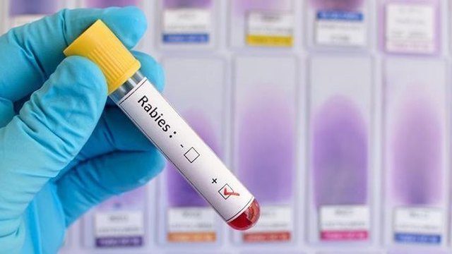Ситуація з антирабічним імуноглобуліном від сказу контрольована, проводиться перерозподіл по регіонах - ЦГЗ