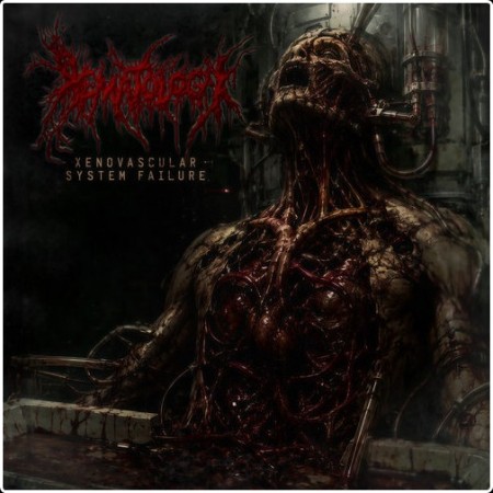 Hematology - Xenovascular System Failure (2026)
